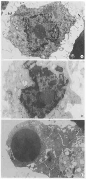 apoptosis of PC12 cells
