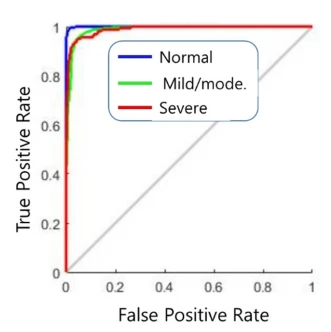 Figure 8.    ROC curve of the results. 